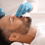 tratamientos estéticos para hombres