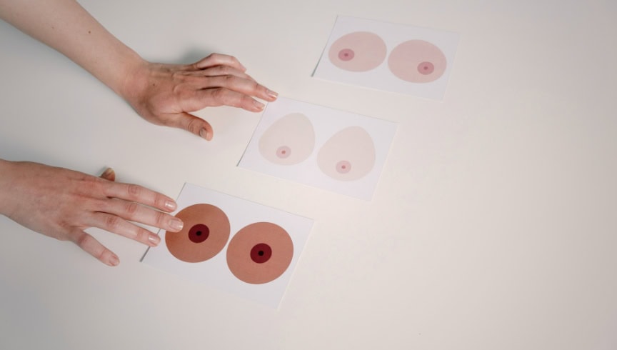 Tarjetas de mamografía y pezones para evaluación de salud mamaria en clínicas APS, centro médico especializado en diagnóstico mamario.