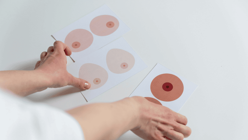 Micropigmentación oncológica: qué es y cuándo se recomienda micropigmentación oncológica (2)