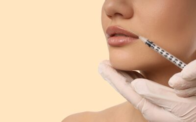 Cuánto tiempo tardan en desinflamarse los labios con acido hialuronico
