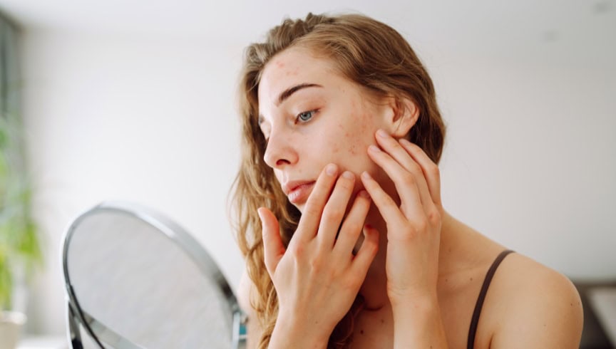 Fases del peeling químico: cómo actúa sobre la piel
