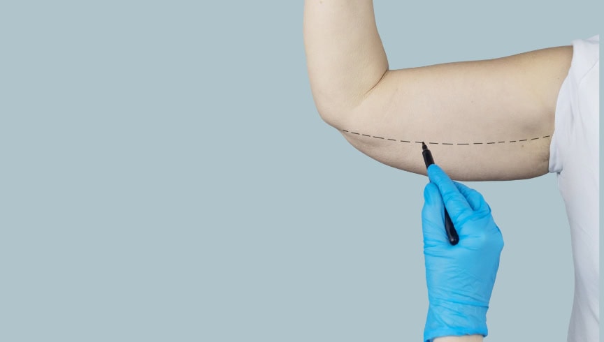 Guía completa: qué es un lifting, qué tipos existen y cuándo está indicado
