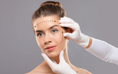 Lifting facial en Barcelona: qué esperar, cicatrices y postoperatorio
