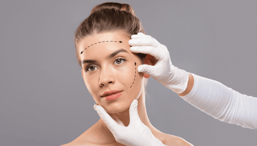 lifting facial postoperatorio